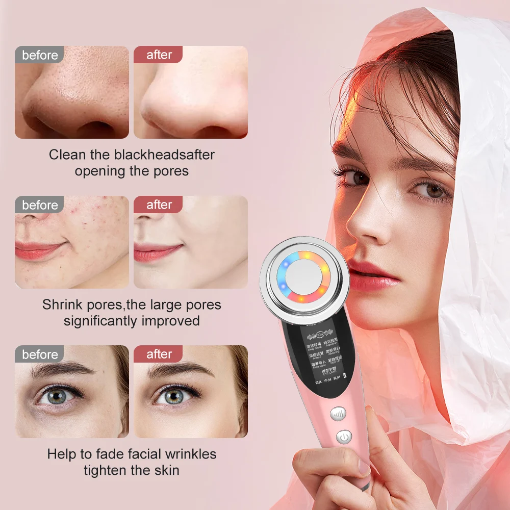 

EMS Face Massager Radio Mesotherapy Electroporation LED Light Therapy Sonic Vibration Wrinkle Removal Skin Tightening Skin Care