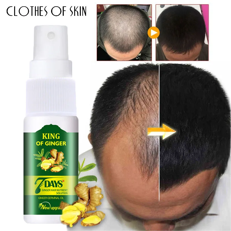 

Ginger 7 Days Hair Growth Serum Hair Loss Treatment Spray Effective Germinal Hair Growth Essential Oil Men Women Hair Care 30ml