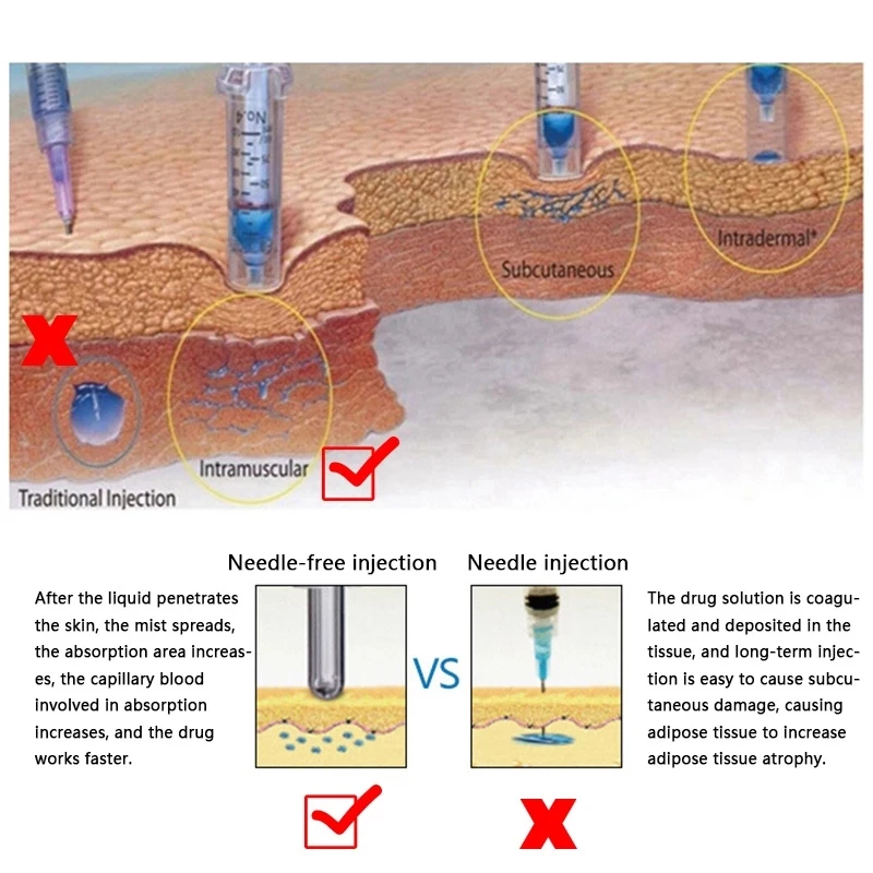 

Pure Gold High Pressure Hyaluronic Acid Pen, Water Syringe Adjustable Gun Hyaluron Pen Kit For Anti Wrinkle Lifting Lip 0.3ML