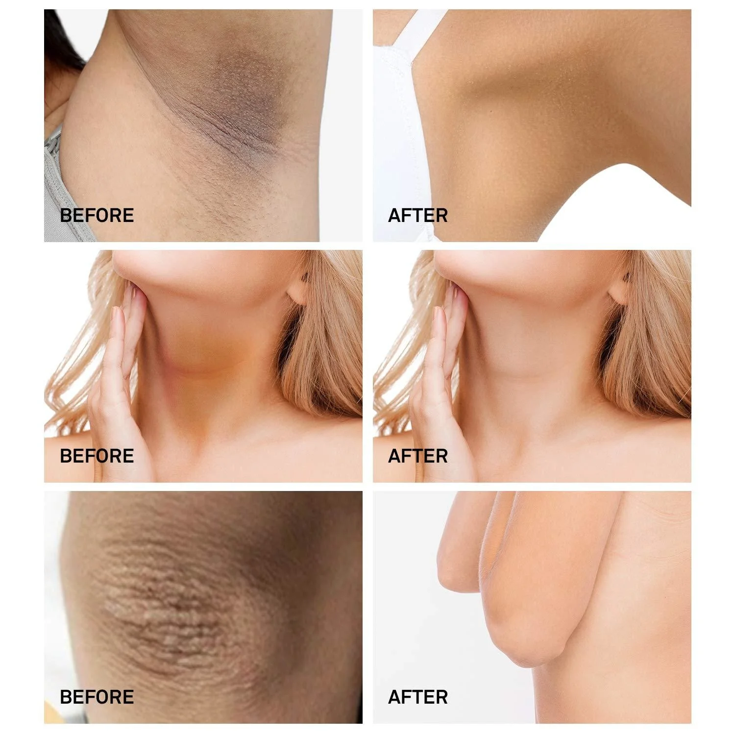 Body Bleaching Cream Armpit Whitening Lightening Underarm Dark Skin Legs Knees Moisturizing Intimate Lotion Care | Красота и здоровье