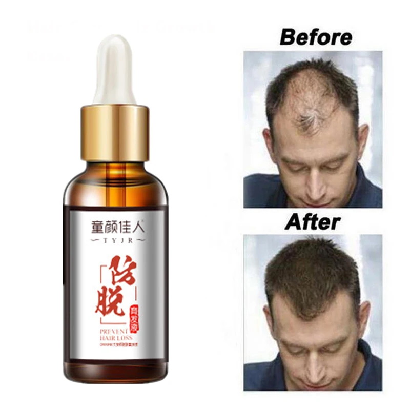 

Hair Care Hair Growth Essential Oils Essence Grow Hair Fluid Prevent Hair Loss Health Care Beauty Dense Hair Growth Serum