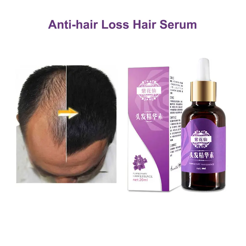 Продукты против выпадения волос натуральные без побочных эффектов для быстрого