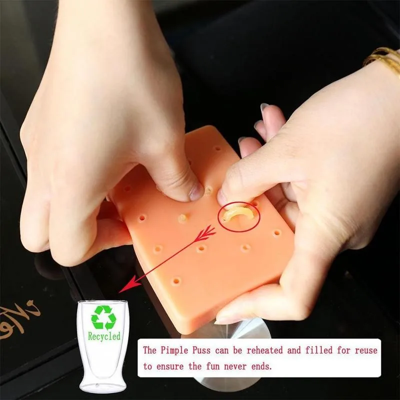 

Pimple Popping Popper Novelty Gags Practical Jokes Toys Funny Remover Stop Squeeze Acne Squishy Anti Stress Toy Christmas Gift