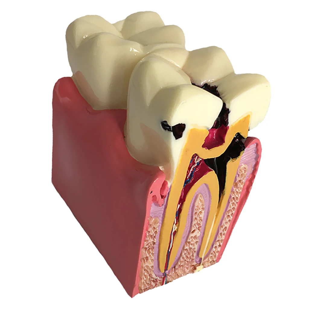 

Teeth Model For Education Tooth Practice Mold for Studying Rearching 2 Teeth