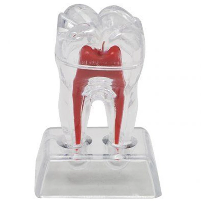 

Large Tooth Molar Model Separable Teaching Demonstration Model Transparent Dentistry Material Lab Teeth Model