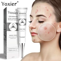 acne repair cream remove acne fade acne marks oil control repair skin brighten skin tighten pores hyaluronic acid skin care 20g