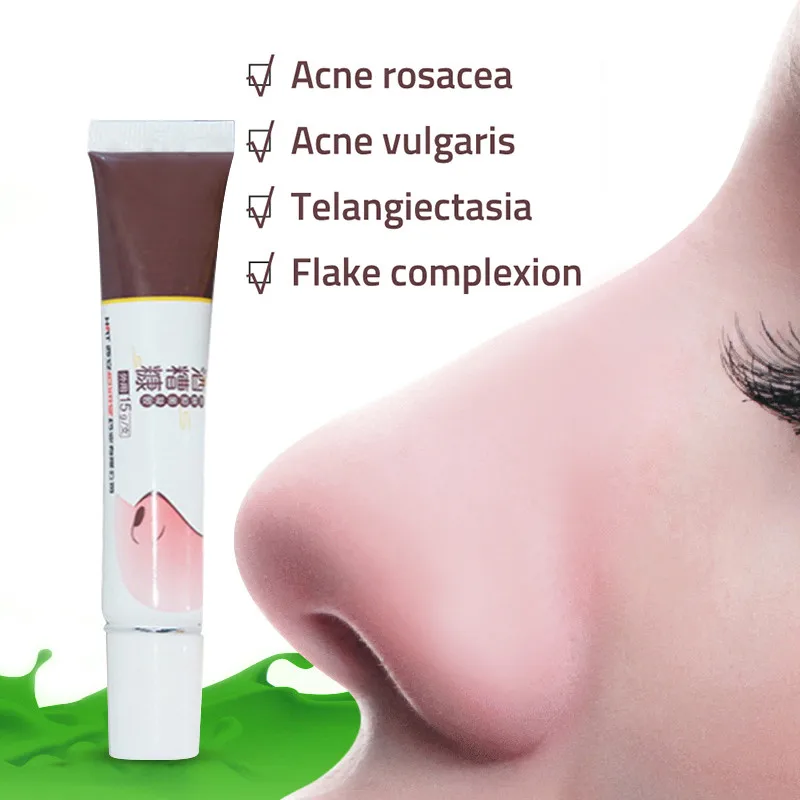 

Herbal Anti Nose Mites Remove Acne Rosacea Cream Red Nose Blackhead Remover Acne Treatment Oil Control Repair Spot