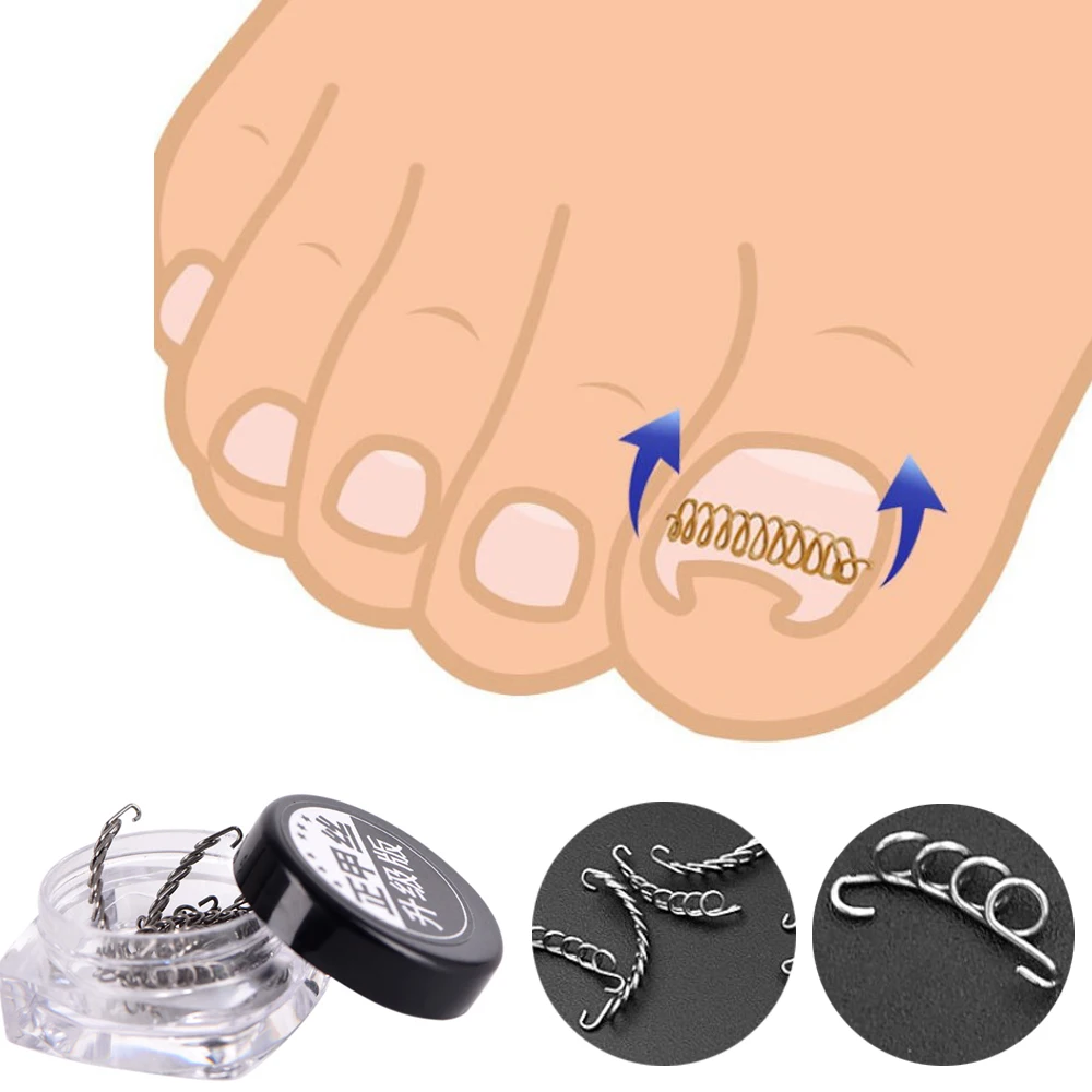 Профессиональный 12 шт./компл. нейл арта вросшие ногти коррекции провода