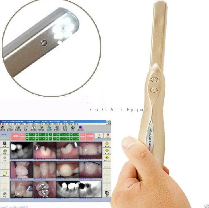 Стоматологическое оборудование внутриоральный эндоскоп 4 мегапикселя 6