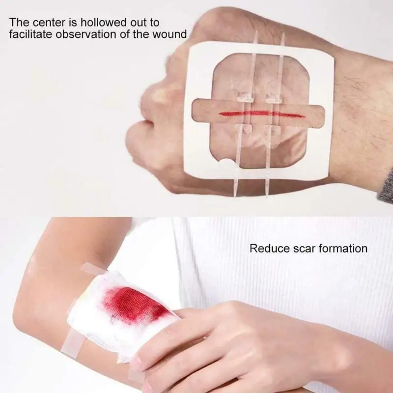

1PCS Zipper Band-aid Painless Wound Closure Device Suture-free Wound Dressing Patches Zip Suture Reducer Band Aid Survival Kit