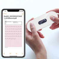 portable bluetooth ecg monitor with oled ekg holter heart health monitor screen show real time ekg electrocardiograma charge