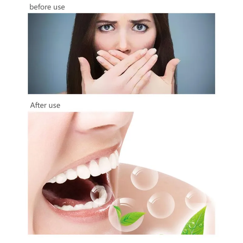 

Stainless Steel Tongue Mouth Cleaner Scraper Fresh Breath Maker Toothbrush Cleaning Oral Dental Hygiene Care Oral Care 1 PCS