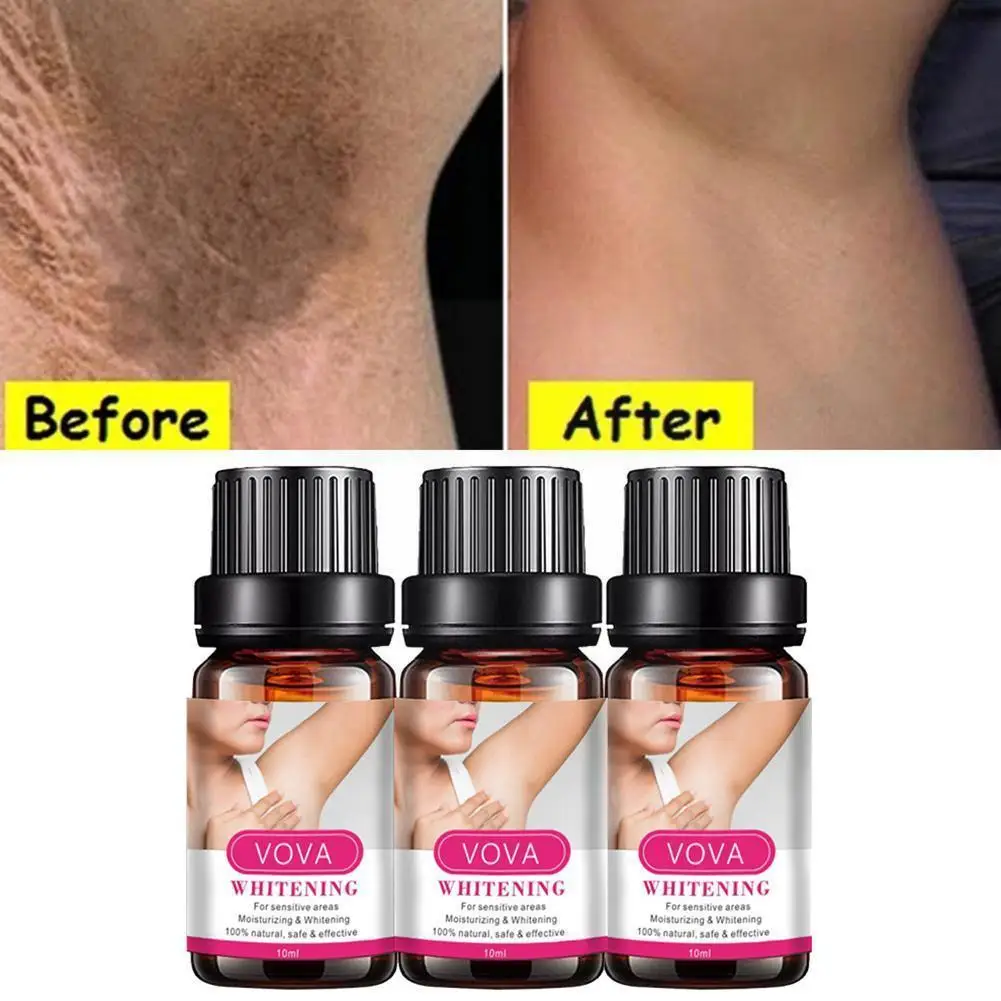 

10ml Armpit Whitening Oil Skin Lightening Bleaching Whitening Body Skin Essential Knees Intimate Dark Oil Cream Underarm Le G0L9