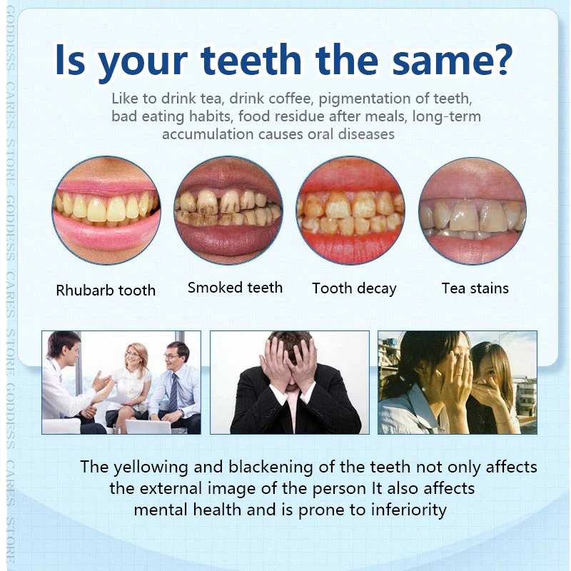 Отбеливание зубов ручка инструменты гигиены полости рта ослепительный гель
