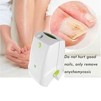 hot selling painless nail fungus laser device with 905nm laser for nail fungus treatment laser for onychomycosis