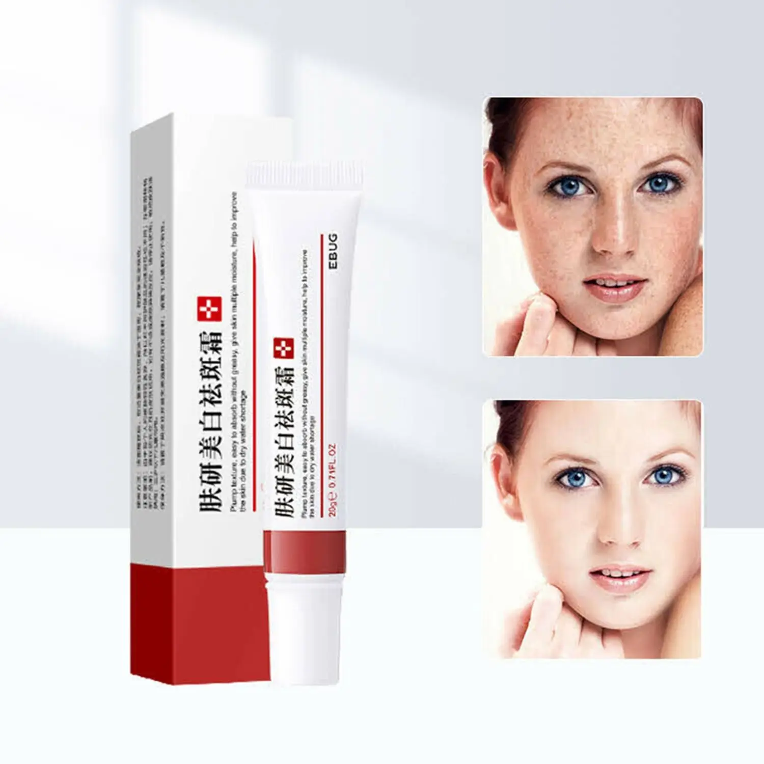 Крем для отбеливания веснушек средство удаления мелазмы меланина против