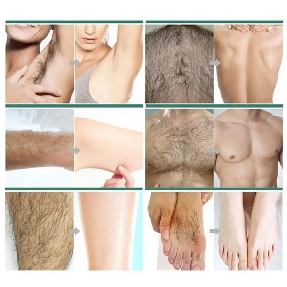 

Mousse Foam Hair Removal Spray Student Whole Body Men And Women Universal Hair Removal Cream Underarms And Legs