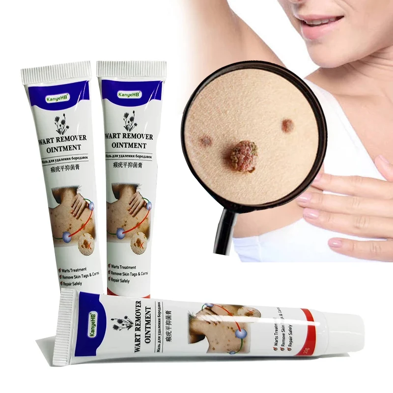 

1pcs Warts Remover Antibacterial Ointment Wart Treatment Cream Skin Tag Remover Herbal Extract Corn Plaster Warts Ointment