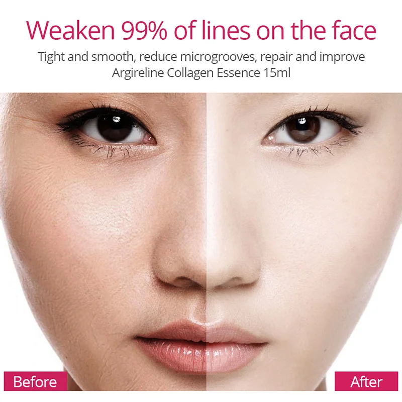 5 шт./кор. корректирующая ампульная эссенция для темных пятен ухода за кожей лица