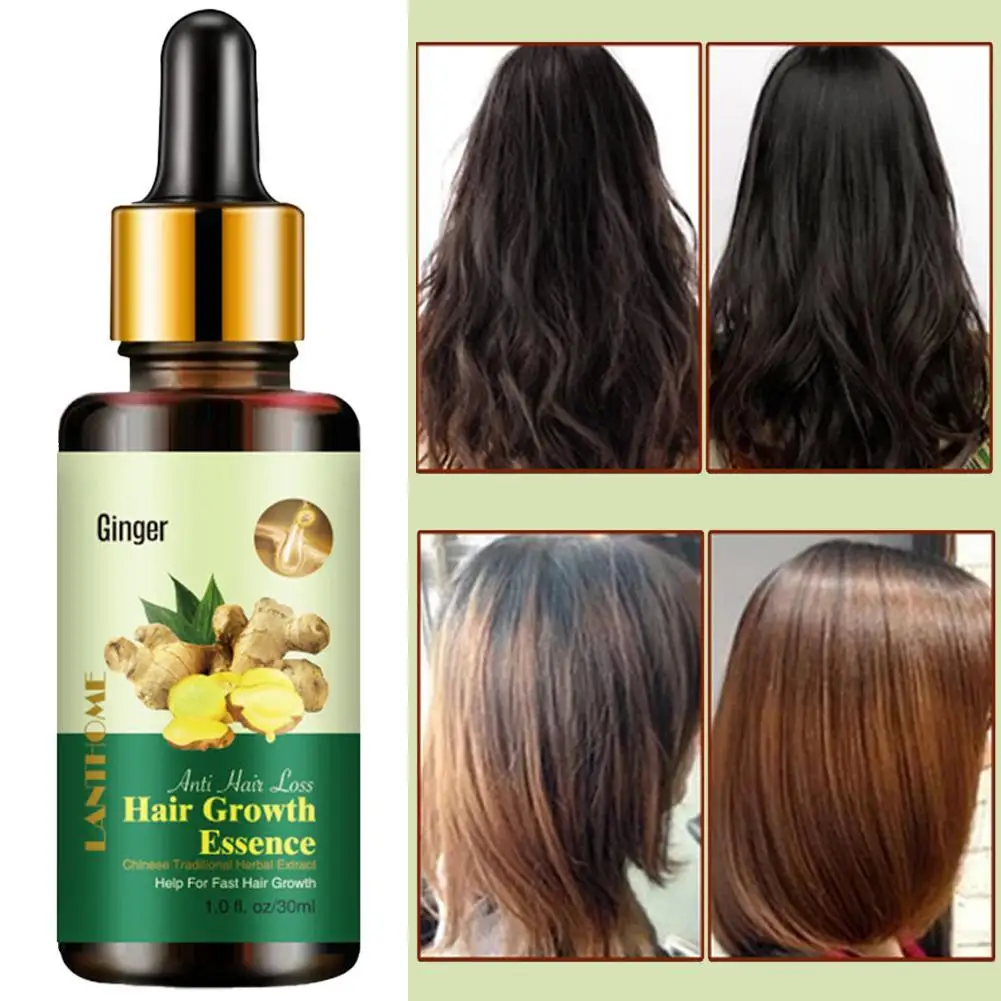 

30ml Ginger Hair Growth Essence Spray Hair Loss Product Anti Regrowth Tools Hair Loss Treatment Care Growth Hair Spray Hair L0G8