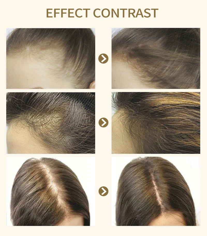 11,11 HAIRINQUE имбирь шампунь бар для выпадения волос шампунь мыло натуральные ингредиенты без химических веществ консервантов шампунь мыло