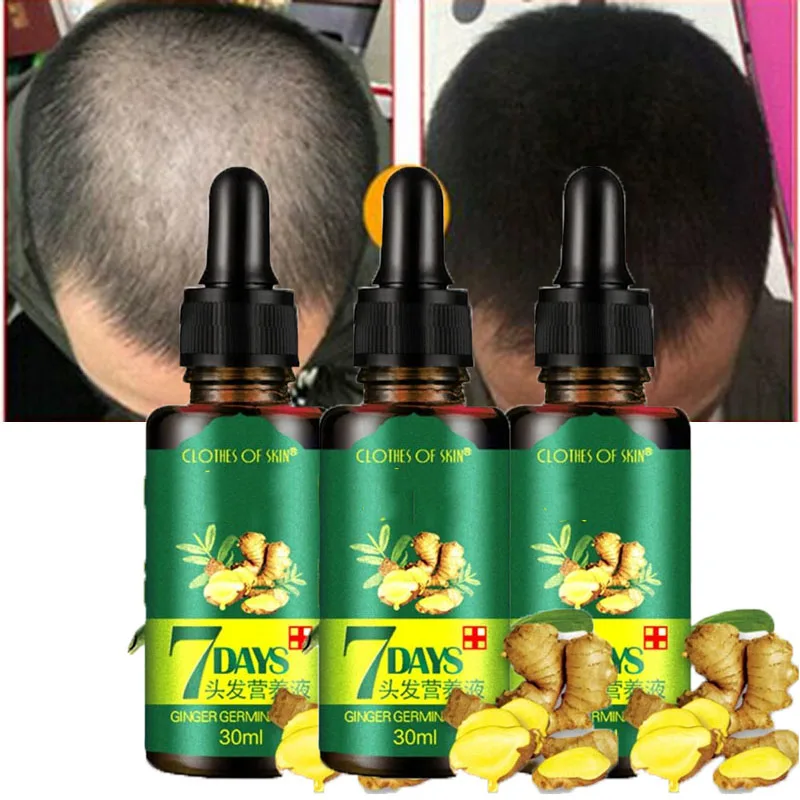 

7 Days Fast Hair Growth Essence Oil Ginger Hair Growth Serum Nourishing Soften Treatment Hair Loss Repair Damaged Hair Serum3PCS