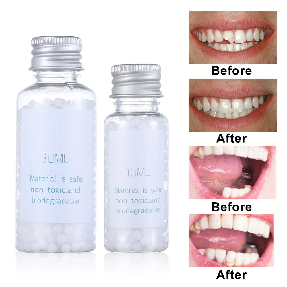 Клей для зубных протезов замена твердого материала временного наполнения зубов