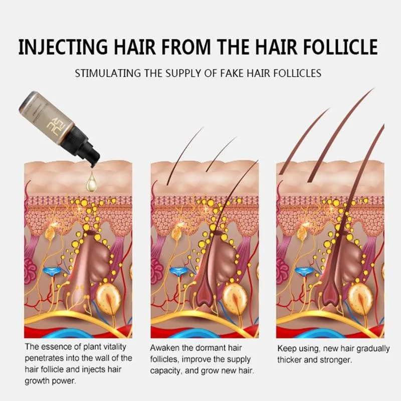 

New Hair Growth Spray Fast Hair Growth Products Hair Hair Hair Women For Thinning Hair Scalp Loss Treatment For Men Hair & T9E8