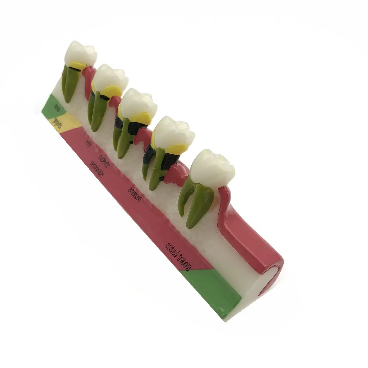 Стоматологический периодонтальный болезни разбирают зуб Typodont модель|model craft|model