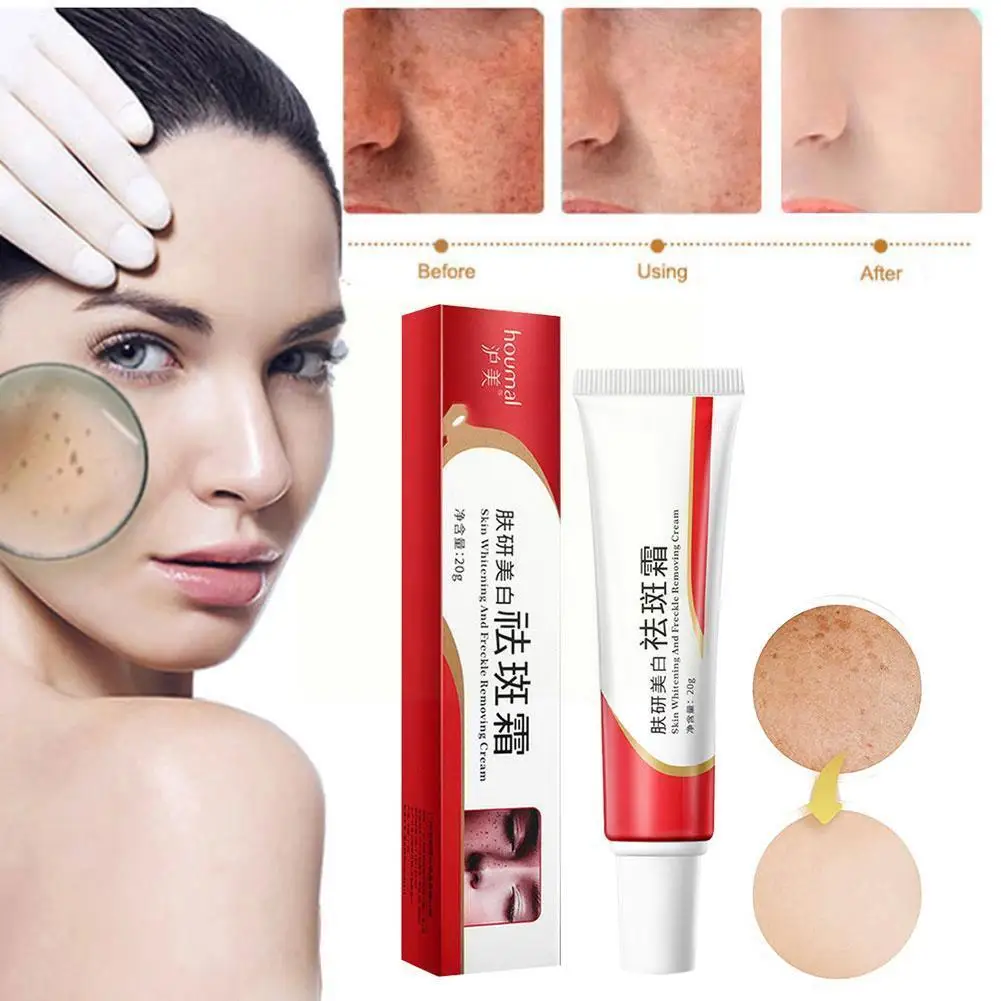 

20ml Whitening Freckle Cream Dark Spots Remove Melasma Whitening Face Cream Brighten Pigment Spots Cream Acne J3o9