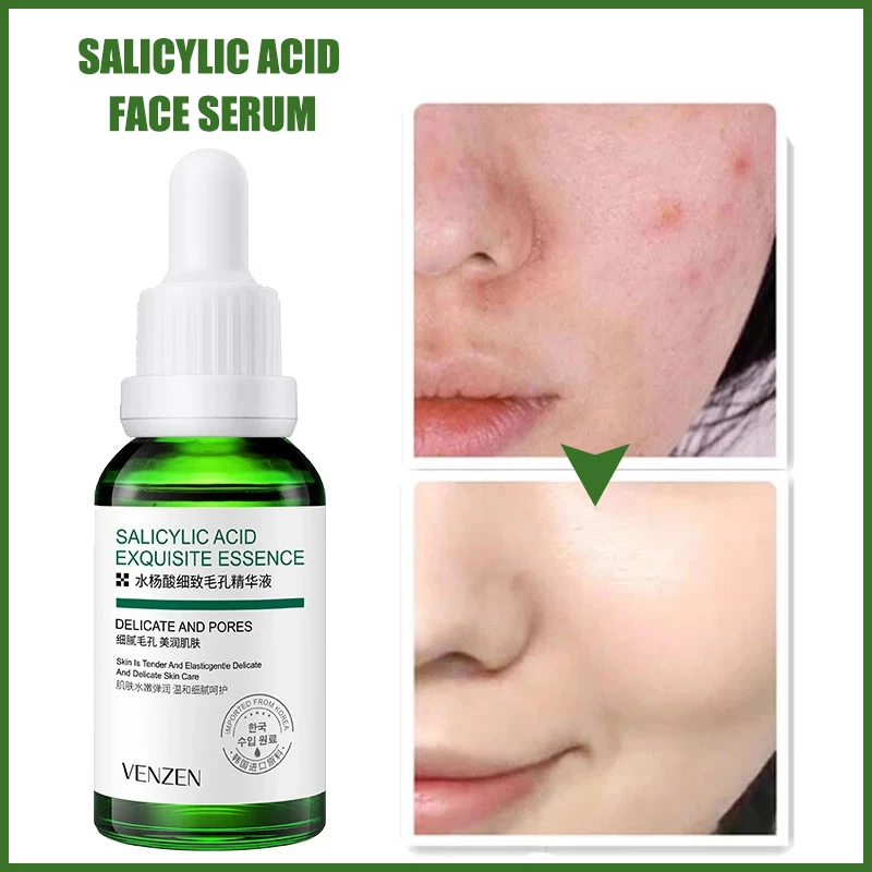 

Aloe Salicylic Acid Acne Treatment Serum Oil Control Shrink Pores Face Essence Hyaluronic Acid Moisturizing Brighten Skin Toner