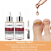 nail care essence fungal nail repair remove onychomycosis toes athletes foot hand and foot skin care2pcs