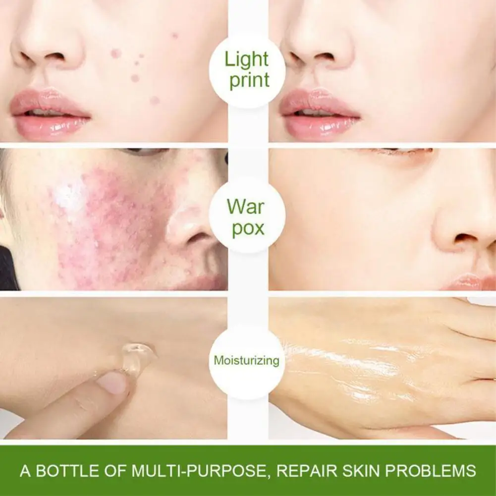 

300g 99% Aloe Vera Soothing Repair Gel Moisture Nourishing Face Scars Skin Sunburn Lightens Acne Remove Cream Repair Cream H6y8