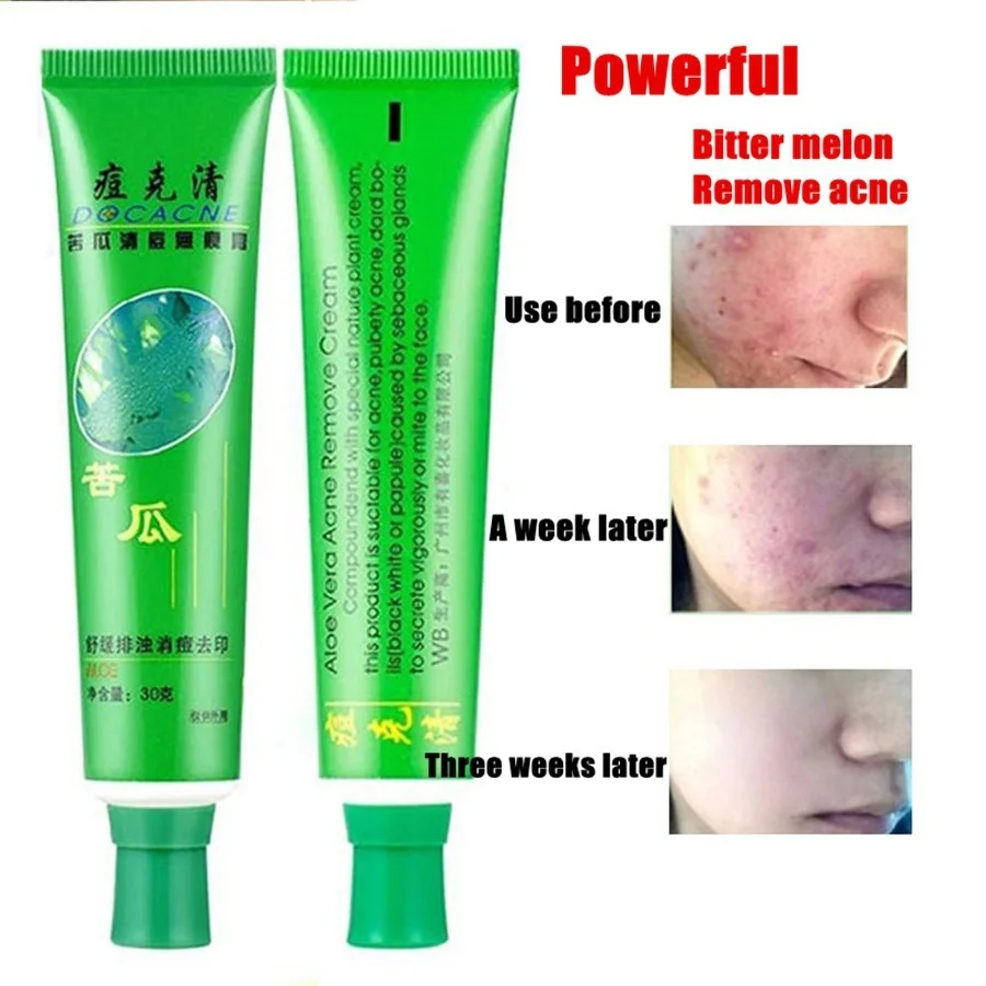 

30g Face Cream Beauty Product Face Skin Repairing Acne Cream Oil Control Acne Remover Facial Skin Care SK88