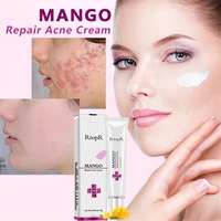 rtopr 15g natural mango extract face acne remover cream acne scar treatment effectively remove pimple scar anti acne cream tslm1