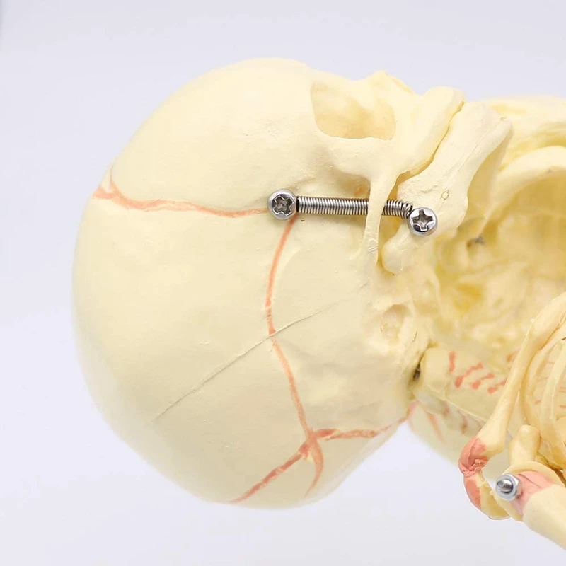 

37cm Human Double Head Baby Skull Skeleton Deformed Head Skull Research Model Anatomy Brain Display Anatomical Model