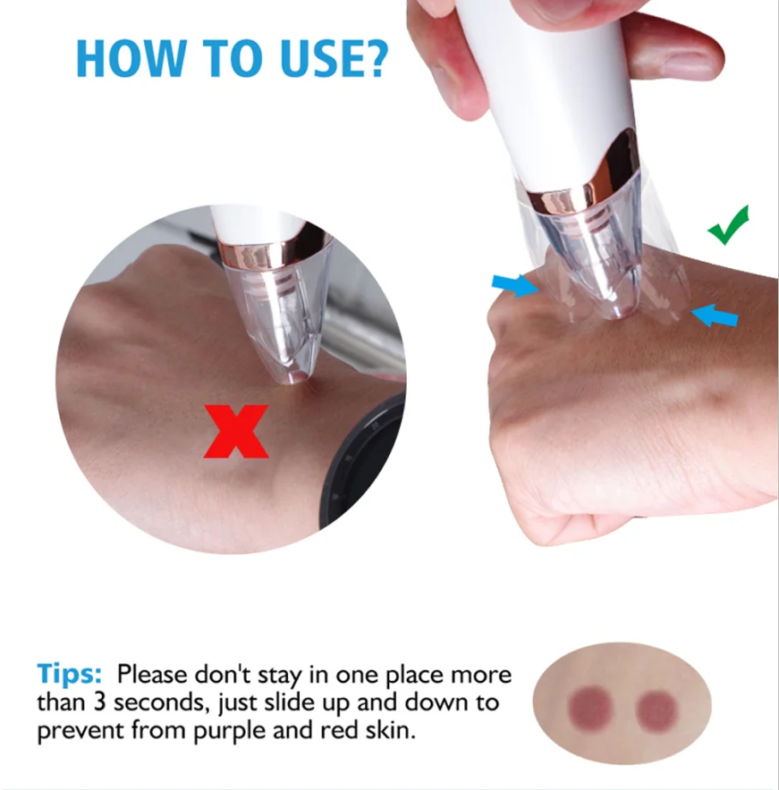 Вакуумный аппарат для удаления черных точек|Устройства чистки лица| |