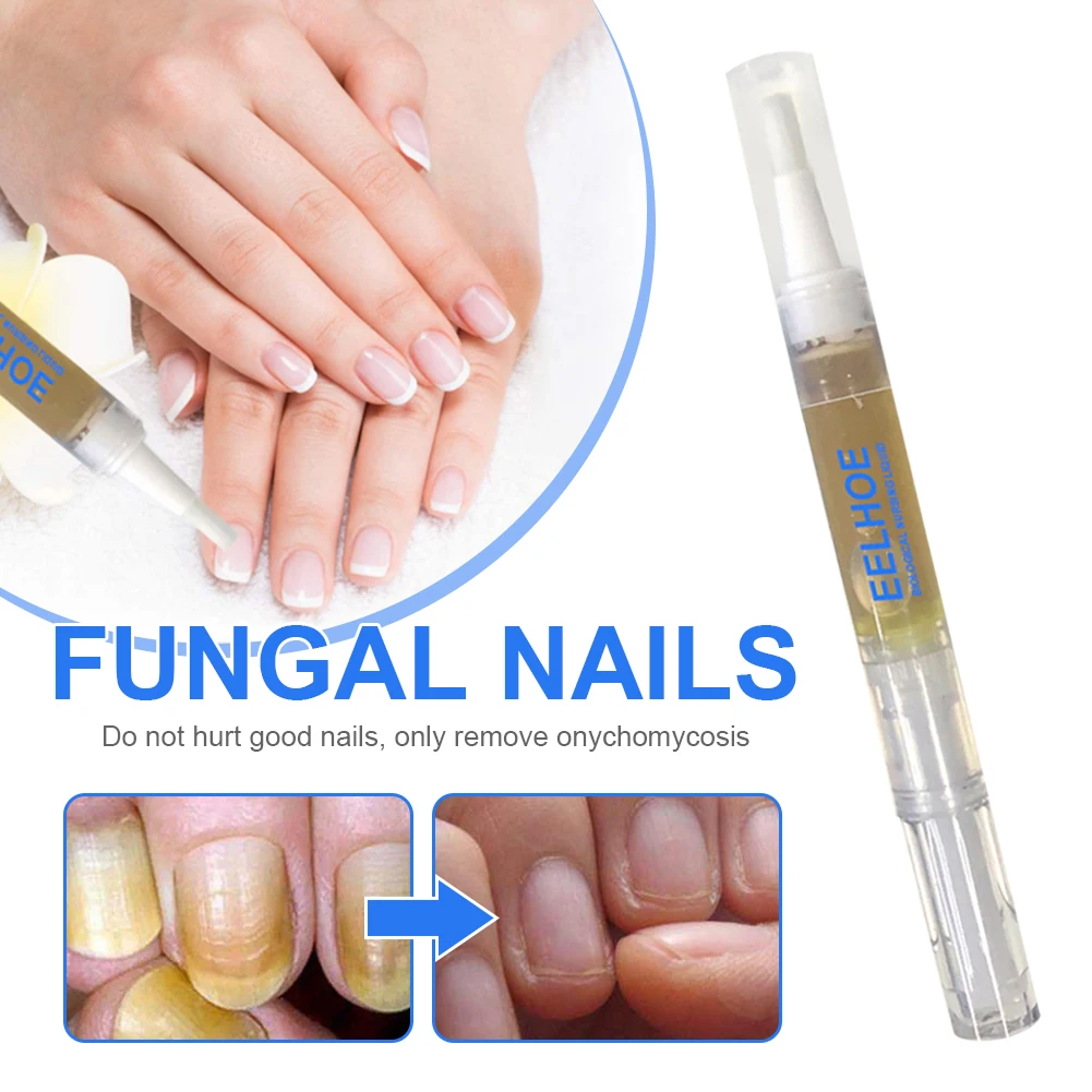 

New Fungal Nails Treatment Solution Effective Painless Fungus Stop Fingernails Toenails Repair Pen Promote New Growth Nail Care