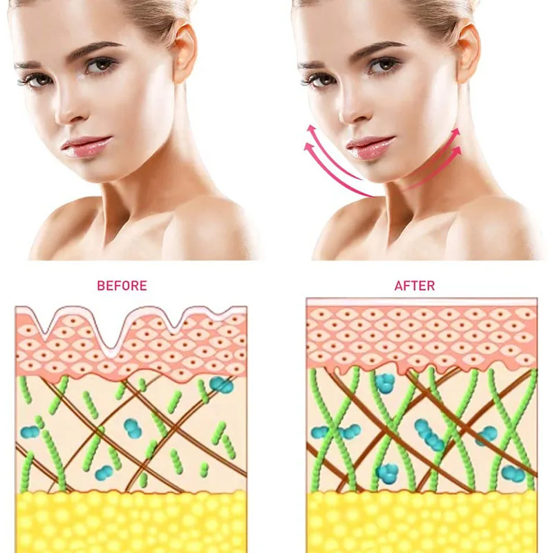 

Mini Facial Massager Microcurrent Face Lift Machine Charging Skin Tightening Rejuvenation Personal Beauty Products Accessories