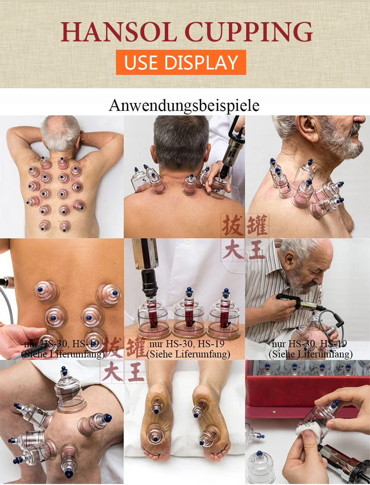 Высококачественный резервуар бытовые вакуумные банки 19 банок для стаза крови