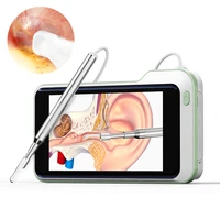 ear inspect camera clean ears scope endoscope 4 3inch screen 3 9mm video visual medical digital otoscope earwax removal tool