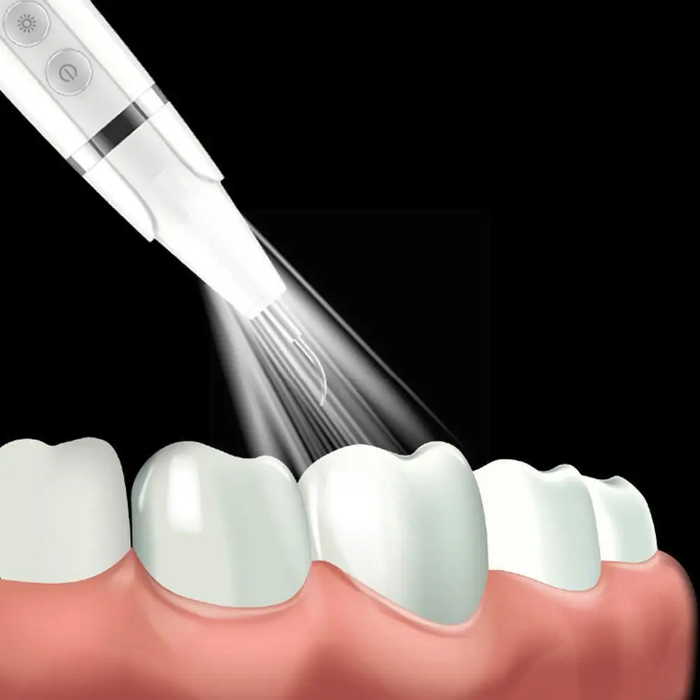 

Electric Dental Tooth Calculus Remover Stains Carbon Tartar Teeth Powder Ultrasonic Vibration Charcoal Cleaner White L3A8