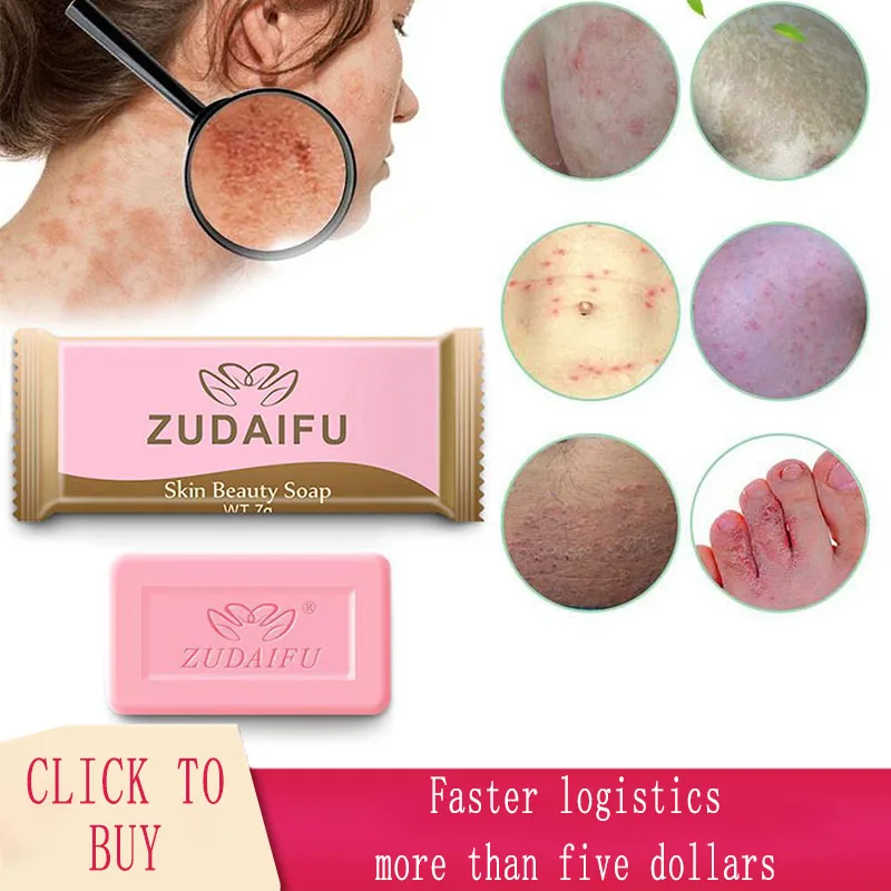 Новый Удаление прыщей поры акне терапии сульсеновое мыло очиститель увлажняющее