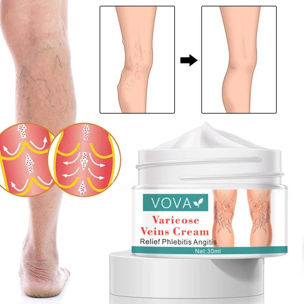 

VOVA Antibacterial Safflower Cream Varicose Vein Cream Relieve Pain Legs Repair Vein Cream 30g