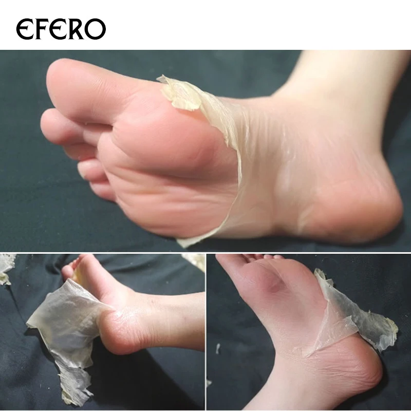 EFERO/1 пара детских масок для ног отшелушивающая маска носки педикюра пилинга