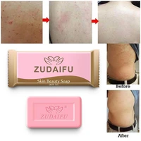 1pcs zudaifu sulfur soap skin conditions acne psoriasis seborrhea eczema anti fungus bath whitening soap shampoo soap skin care