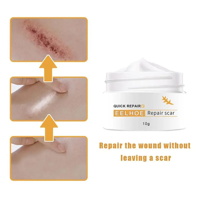 New Acne Scar Removal Cream Face Pimples Maternity Stretch Marks Repair Gel body Smoothing Whitening Moisturizing Skin Care 30g
