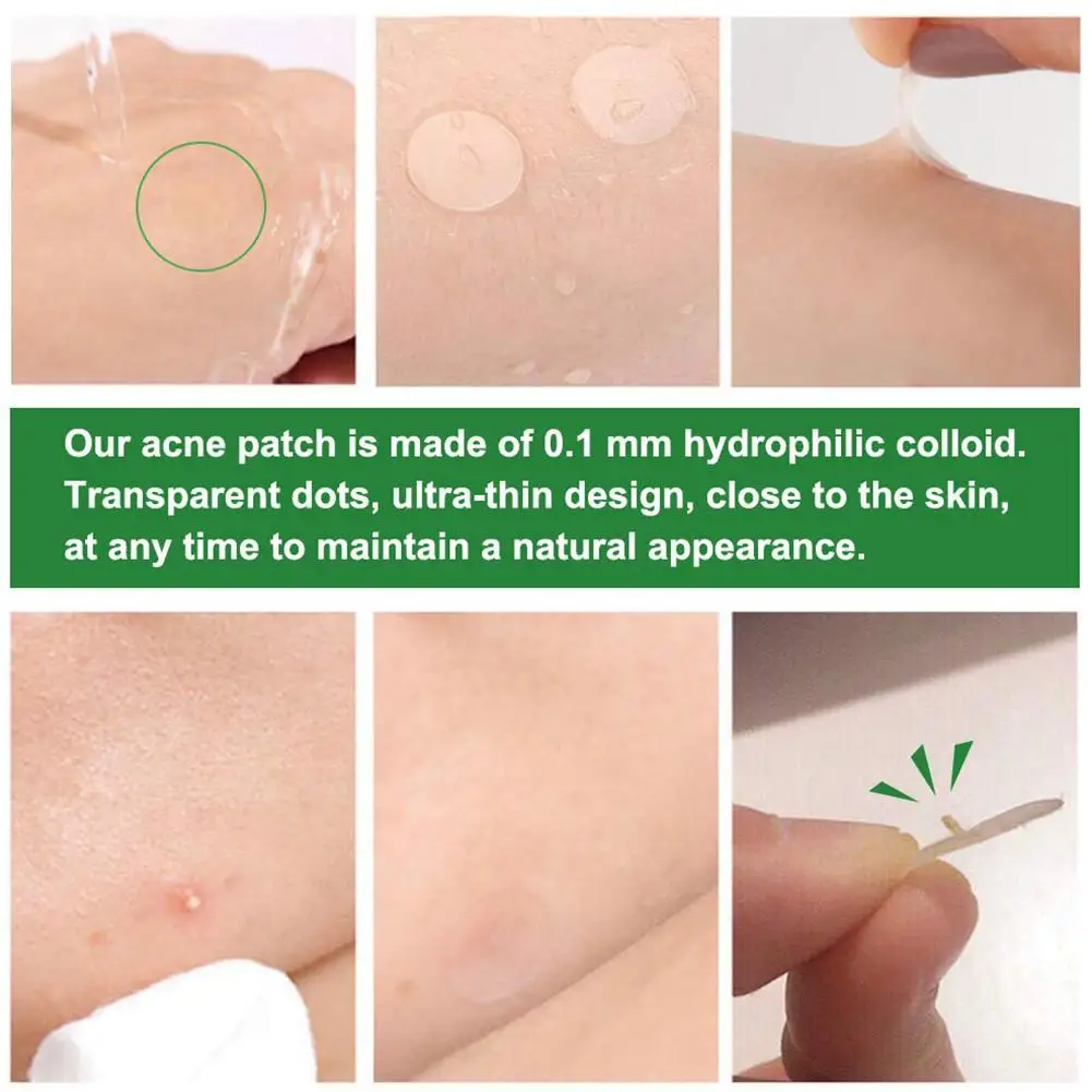 24 шт невидимые акне Удаление прыщей патч может поглощать выделений эффективно