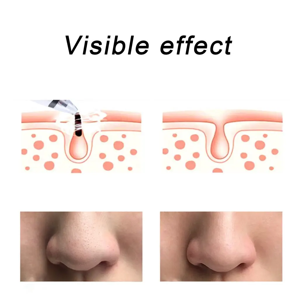 

Beauty Blackhead Remover Vacuum Pore Acne Pimple Face Removal Deep Nose Suction Facial Diamond Clean Skin Tool
