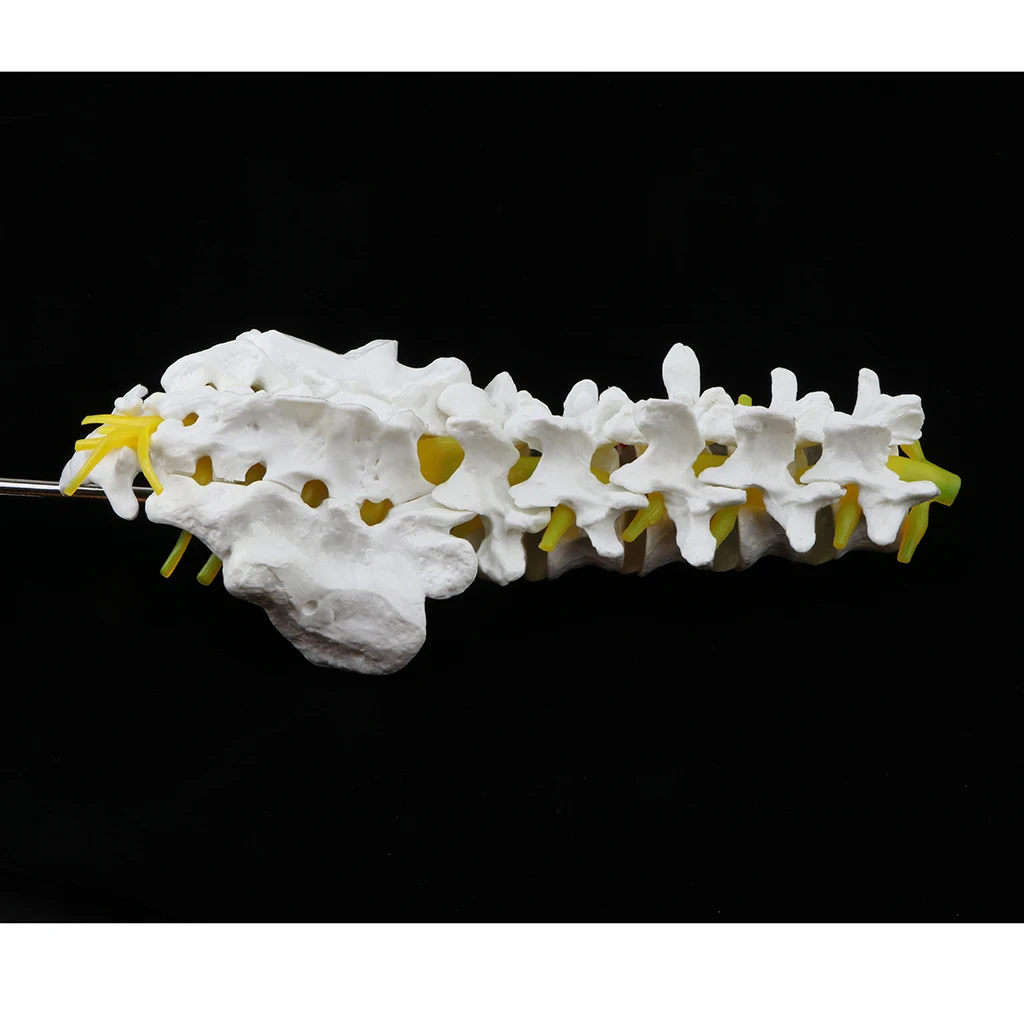 

Anatomical 1:1 Human Spine Model - Highly Detailed to Show Forms and Structure of Lumbar Vertebrae, 30CM Height